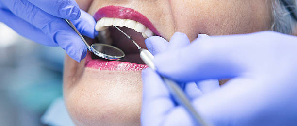 Best Broken or Chipped Tooth Repair in Albany, IN